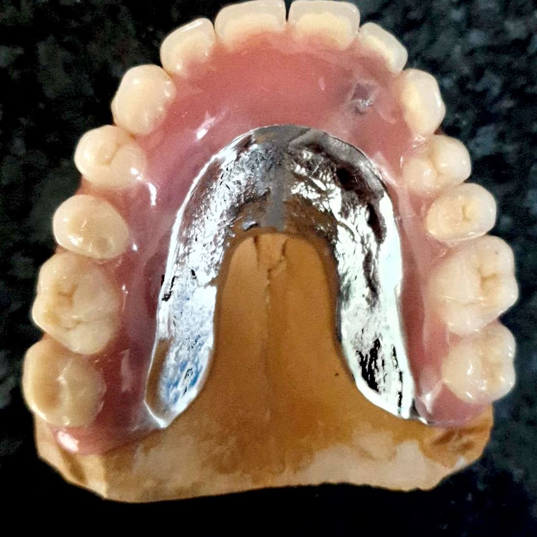 Rodental Laboratorio Dental Prótesis metálica