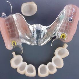 Rodental Laboratorio Dental Prótesis fija