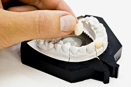Rodental Laboratorio Dental dentista-con-molde-para-dentadura